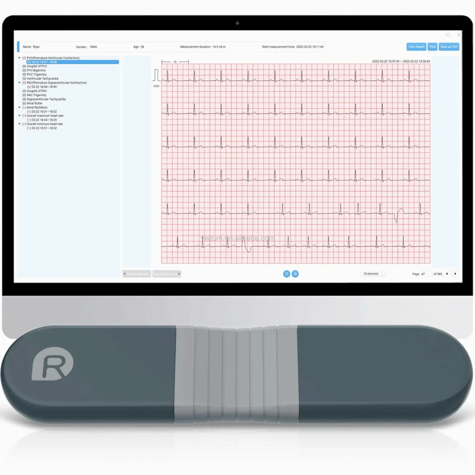 Grabadora dinámica inalámbrica - Ecg Patch Monitor reseña y precio